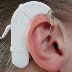 Fijador para oreja SmartEar